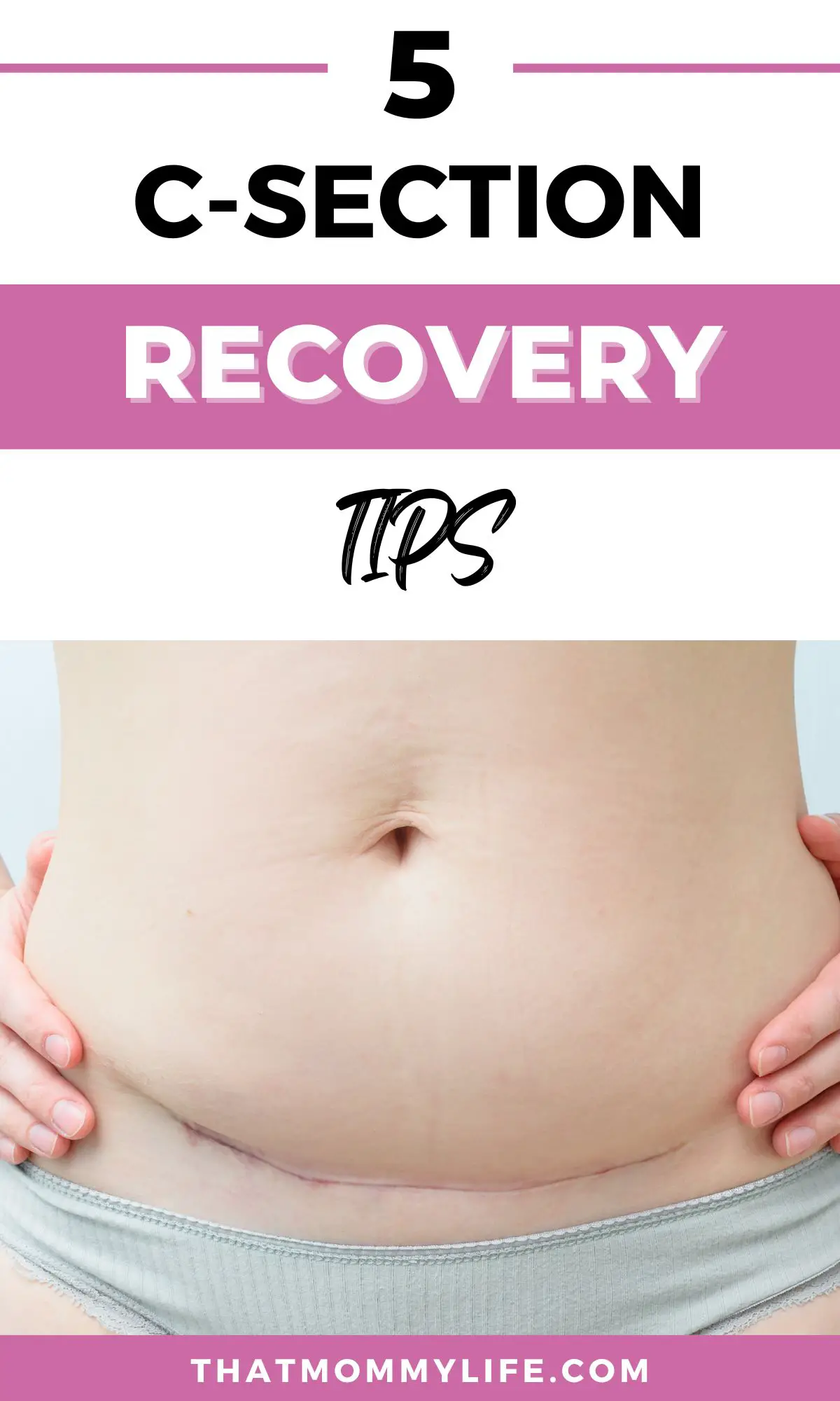 c-section recovery